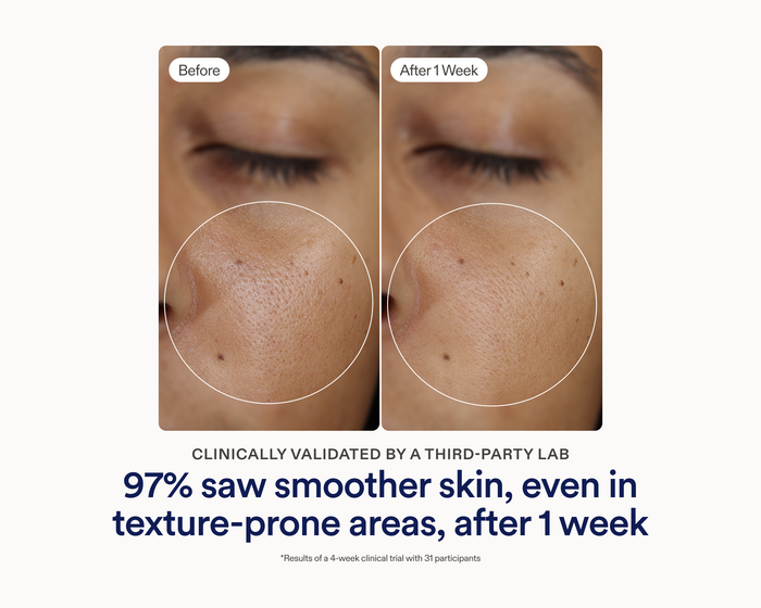 Side-by-side before and after clinical photos showing visibly smoother skin texture on the cheek after 1 week of using Skinfix Ceramide Prime Whipped Cream, with text reading: Clinically validated by a third-party lab — 97% saw smoother skin, even in texture-prone areas, after 1 week.