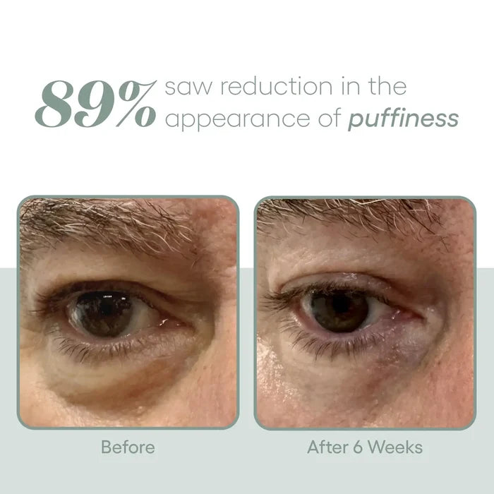 Before-and-after close-ups of an eye, labeled 'Before’ and 'After 6 Weeks.’ Text states that 89% saw a reduction in the appearance of puffiness.