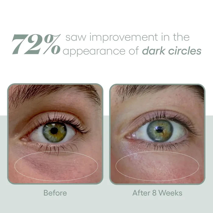 Before-and-after close-ups of the under-eye area, labeled 'Before' and 'After 8 Weeks.' Text states that 72% saw improvement in the appearance of dark circles.