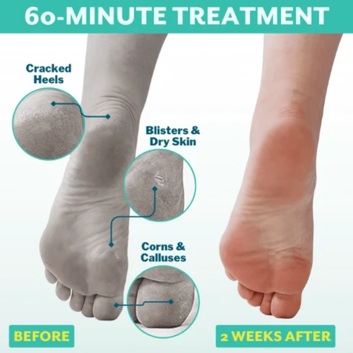 Patchology PoshPeel PediCure