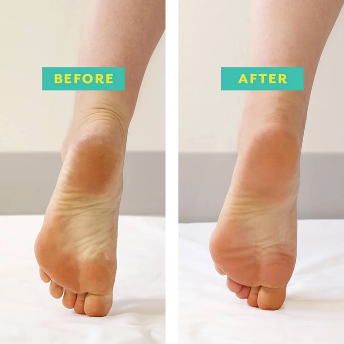 Patchology PoshPeel PediCure